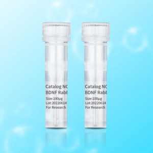 15 Lipoxygenase 1 Antibody